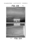 HAIR REMOVAL APPARATUS FOR PERSONAL USE AND THE METHOD OF USING SAME diagram and image