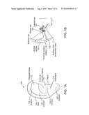 SYSTEMS AND METHODS FOR ANESTHETIZING EAR TISSUE diagram and image