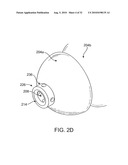 SYSTEMS AND METHODS FOR ANESTHETIZING EAR TISSUE diagram and image