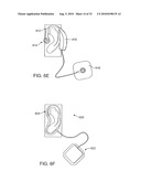 SYSTEMS AND METHODS FOR ANESTHETIZING EAR TISSUE diagram and image