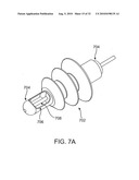 SYSTEMS AND METHODS FOR ANESTHETIZING EAR TISSUE diagram and image