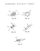 SYSTEMS AND METHODS FOR ANESTHETIZING EAR TISSUE diagram and image