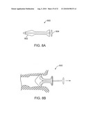 SYSTEMS AND METHODS FOR ANESTHETIZING EAR TISSUE diagram and image