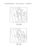 SYSTEMS AND METHODS FOR ANESTHETIZING EAR TISSUE diagram and image