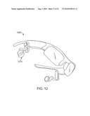 SYSTEMS AND METHODS FOR ANESTHETIZING EAR TISSUE diagram and image