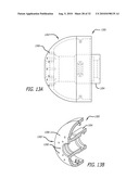 SYSTEMS AND METHODS FOR ANESTHETIZING EAR TISSUE diagram and image