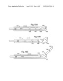 Percutaneous tools and bone pellets for vertebral body reconstruction diagram and image