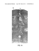 APPARATUS AND METHOD FOR DELIVERING BIOLOGICALLY-ACTIVE SUBSTANCES OR MICRO-MEDICAL DEVICES TO A TARGET diagram and image