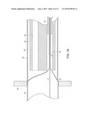 SURGICAL DEVICE diagram and image