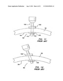 CANNULA WITH A DEPLOYABLE EXTERNAL THREAD diagram and image