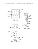 CANNULA WITH A DEPLOYABLE EXTERNAL THREAD diagram and image