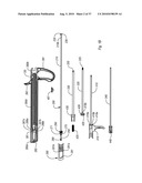 EXPANDABLE INTRODUCER SHEATH TO PRESERVE GUIDEWIRE ACCESS diagram and image