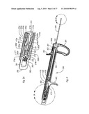 EXPANDABLE INTRODUCER SHEATH TO PRESERVE GUIDEWIRE ACCESS diagram and image