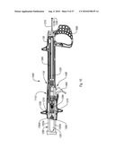 EXPANDABLE INTRODUCER SHEATH TO PRESERVE GUIDEWIRE ACCESS diagram and image