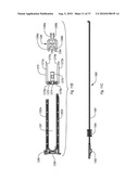 EXPANDABLE INTRODUCER SHEATH TO PRESERVE GUIDEWIRE ACCESS diagram and image