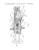 EXPANDABLE INTRODUCER SHEATH TO PRESERVE GUIDEWIRE ACCESS diagram and image