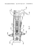 EXPANDABLE INTRODUCER SHEATH TO PRESERVE GUIDEWIRE ACCESS diagram and image