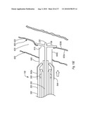 EXPANDABLE INTRODUCER SHEATH TO PRESERVE GUIDEWIRE ACCESS diagram and image