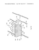 EXPANDABLE INTRODUCER SHEATH TO PRESERVE GUIDEWIRE ACCESS diagram and image