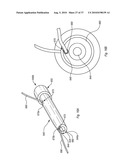 EXPANDABLE INTRODUCER SHEATH TO PRESERVE GUIDEWIRE ACCESS diagram and image