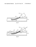 Expandable Introducer Sheaths and Methods for Manufacture and Use diagram and image