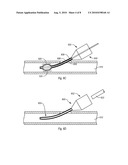 Expandable Introducer Sheaths and Methods for Manufacture and Use diagram and image