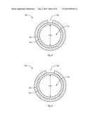 Expandable Introducer Sheaths and Methods for Manufacture and Use diagram and image