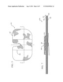 REINFORCED CLOSURE ANCHOR diagram and image