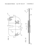 REINFORCED CLOSURE ANCHOR diagram and image