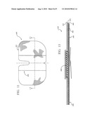 REINFORCED CLOSURE ANCHOR diagram and image