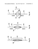 DEVICES, SYSTEMS, AND METHODS FOR VALVE REMOVAL diagram and image