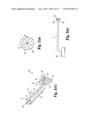 Method and instrumentation for posterior interbody fusion diagram and image