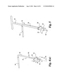 Method and instrumentation for posterior interbody fusion diagram and image