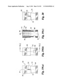 Method and instrumentation for posterior interbody fusion diagram and image