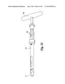 Method and instrumentation for posterior interbody fusion diagram and image