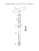 Method and instrumentation for posterior interbody fusion diagram and image