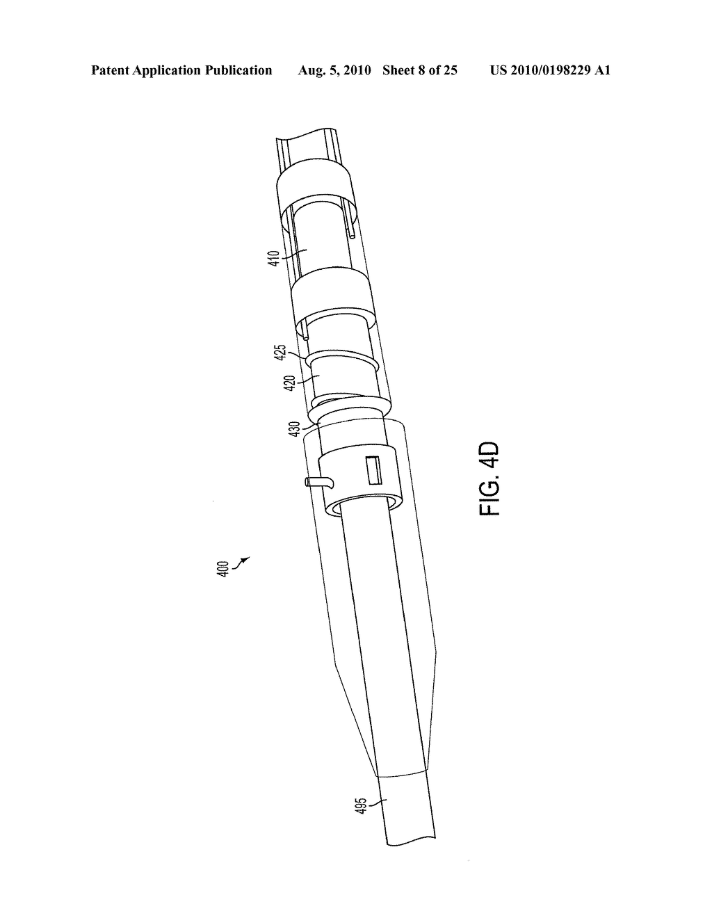 LEAD EXTRACTION METHODS AND APPARATUS - diagram, schematic, and image 09