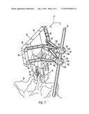 MINIATURE BONE-ATTACHED SURGICAL ROBOT diagram and image