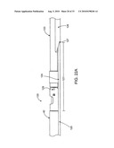 DEBULKING CATHETERS AND METHODS diagram and image