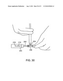 DEBULKING CATHETERS AND METHODS diagram and image