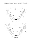 Method and apparatus for minimally invasive treatment of unstable pelvic ring injuries diagram and image