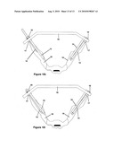 Method and apparatus for minimally invasive treatment of unstable pelvic ring injuries diagram and image