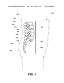 LOW PROFILE BONE SCREW EXTENDER AND ITS APPLICATION IN MINIMUM INVASIVE SPINAL SURGERIES diagram and image