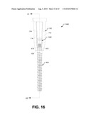 LOW PROFILE BONE SCREW EXTENDER AND ITS APPLICATION IN MINIMUM INVASIVE SPINAL SURGERIES diagram and image