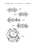 Intervertebral disc inserting device diagram and image