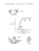 Intervertebral disc inserting device diagram and image