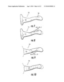 DEVICES FOR VESTIBULAR OR CRANIAL NERVE STIMULATION diagram and image