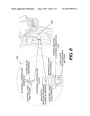  APPARATUS, SYSTEM AND METHOD FOR THERAPEUTIC TREATMENT OF OBSTRUCTIVE SLEEP APNEA diagram and image