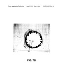 COATING FOR IMPLANTABLE DEVICES AND A METHOD OF FORMING THE SAME diagram and image