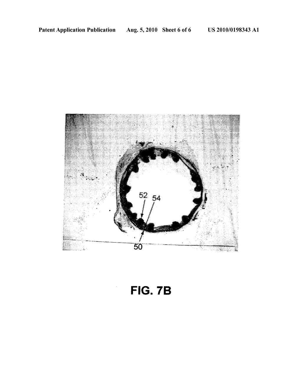 COATING FOR IMPLANTABLE DEVICES AND A METHOD OF FORMING THE SAME - diagram, schematic, and image 07